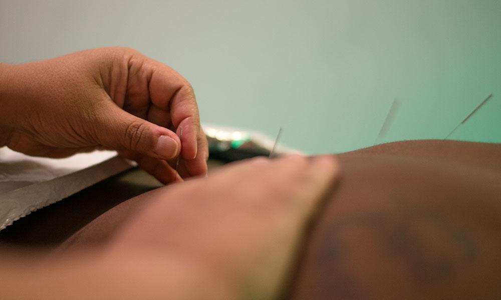 Acupuncture Insurance at Third Root